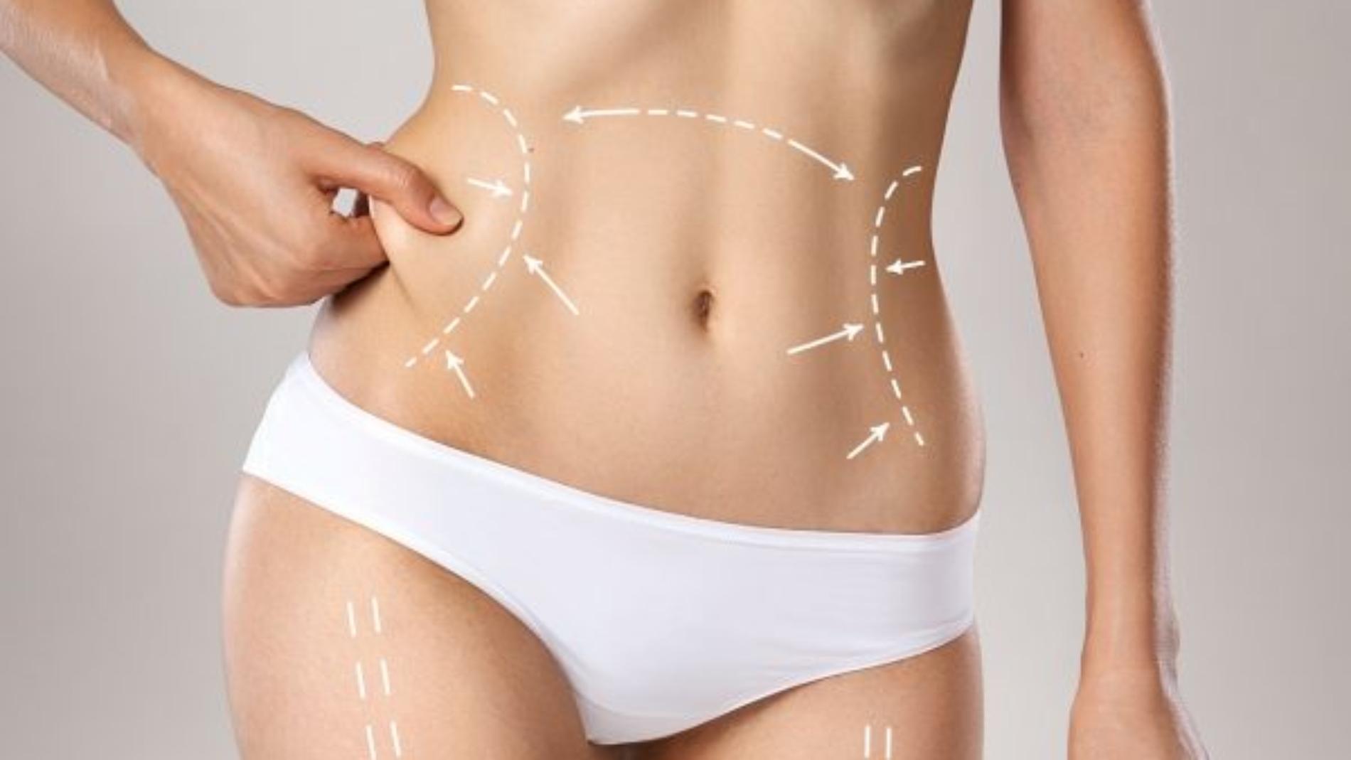 Sculpsure Fat Reduction Suwanee, non surgical fat reduction near me