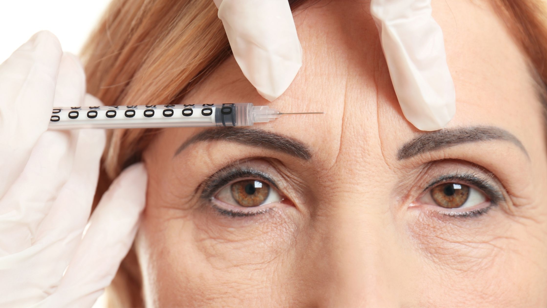 Facial Rejuvenation enhacing your beauty at Medical Aesthetics of Suwanee
