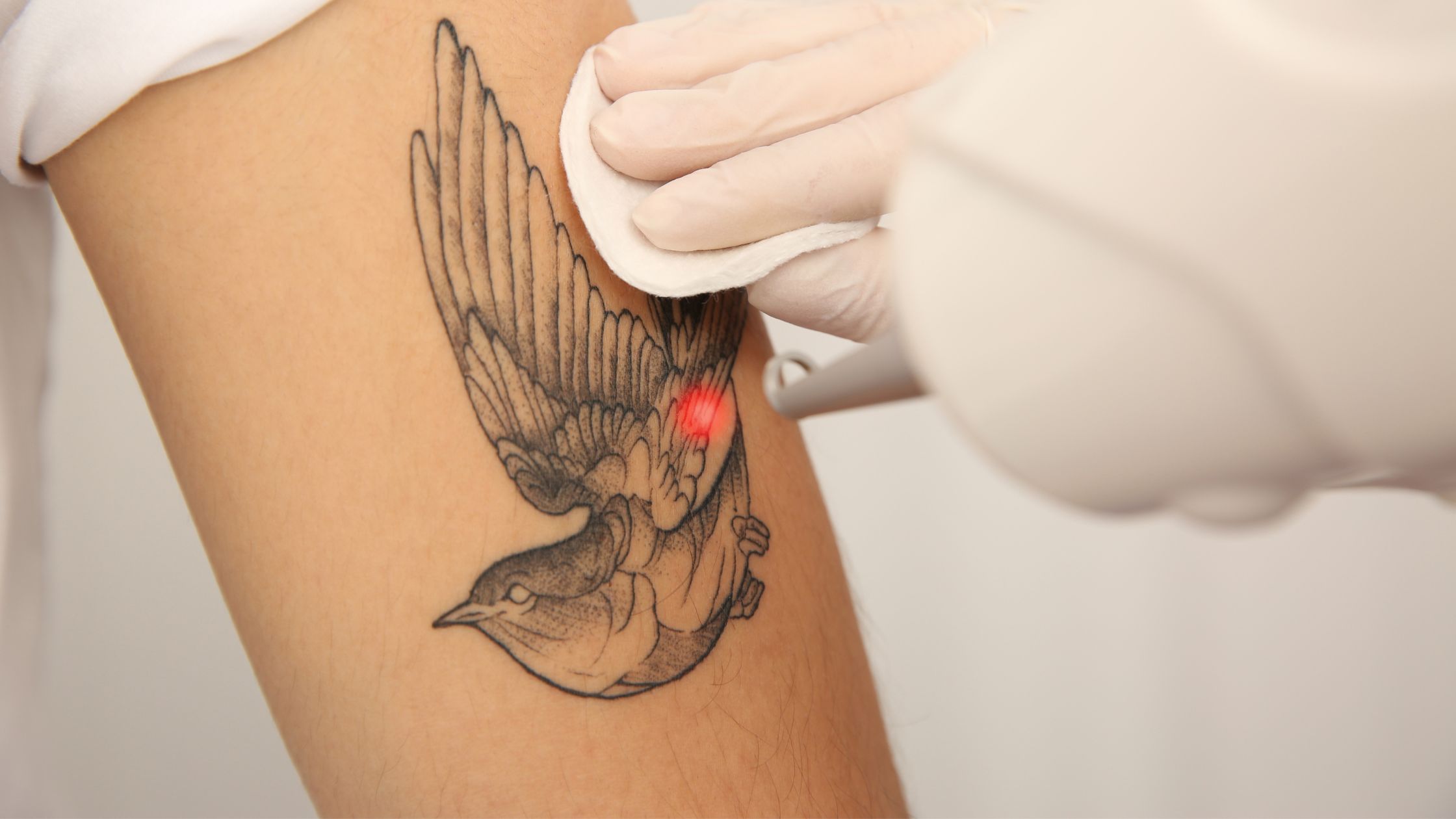 best Suwanee tattoo removal, tattoo removal near me