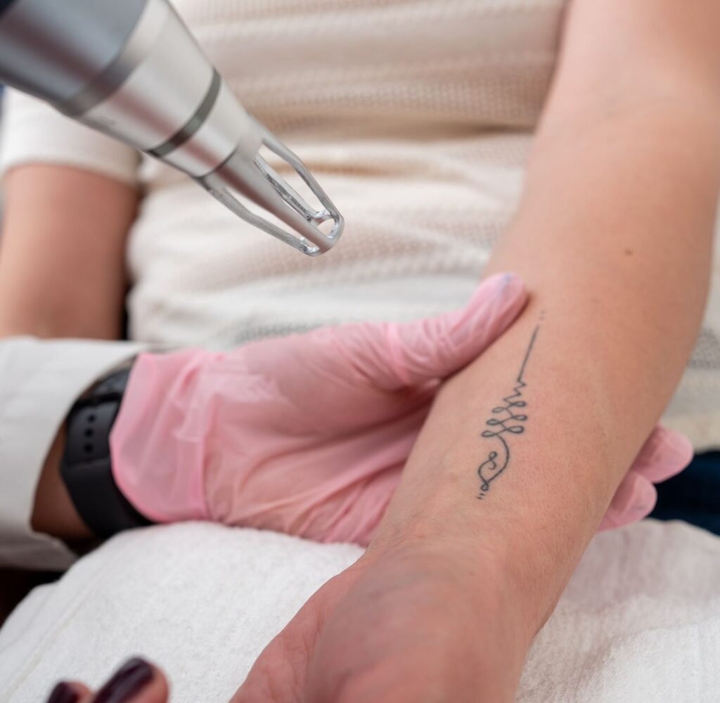cosmetic tattoo removal - medical aesthetics of suwanee